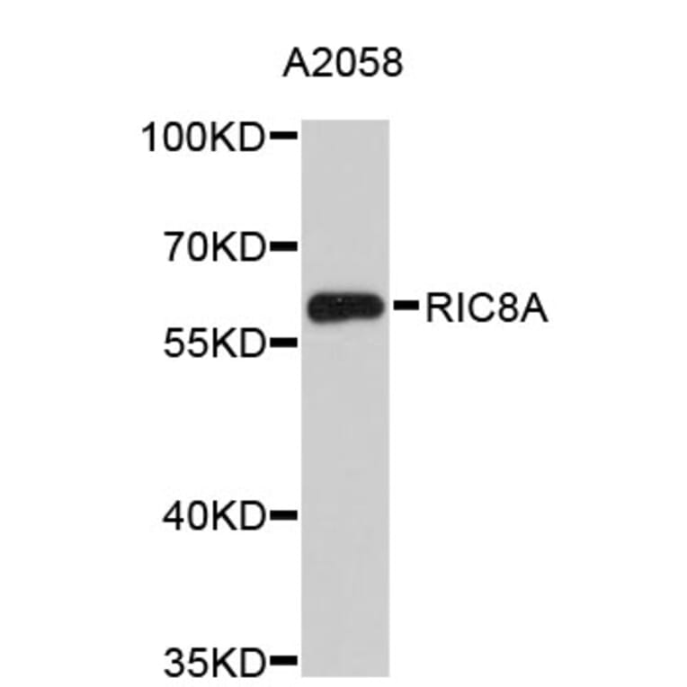 Western Blot - Anti-RIC8A Antibody (A4910) - Antibodies.com