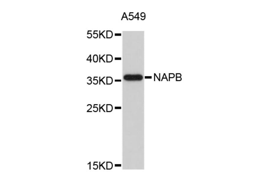 Western Blot - Anti-NAPB Antibody (A4913) - Antibodies.com