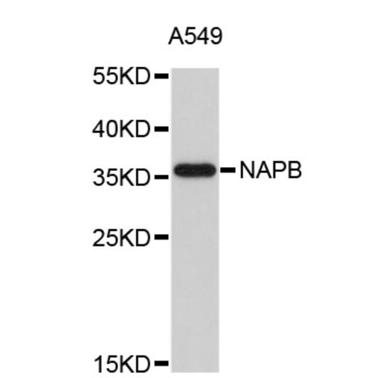 Western Blot - Anti-NAPB Antibody (A4913) - Antibodies.com
