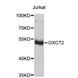 Western Blot - Anti-OXCT2 Antibody (A4917) - Antibodies.com