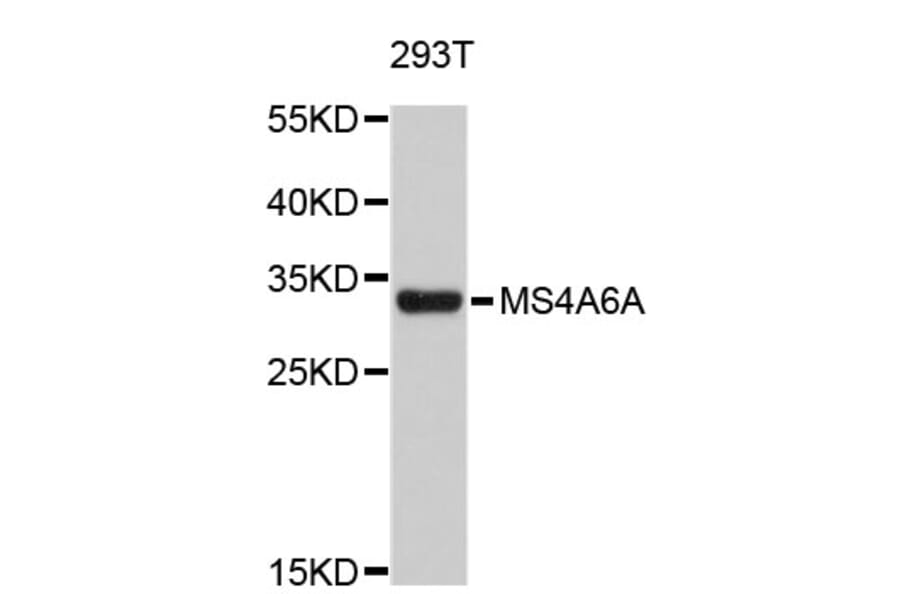Western Blot - Anti-MS4A6A Antibody (A4926) - Antibodies.com