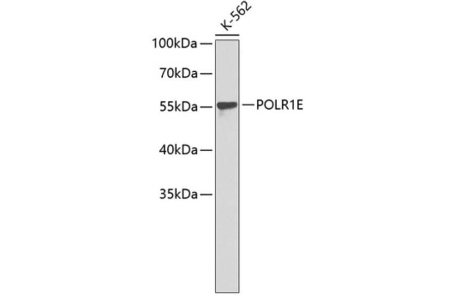 Western Blot - Anti-POLR1E Antibody (A4930) - Antibodies.com