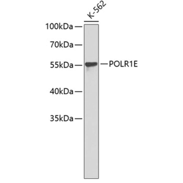 Western Blot - Anti-POLR1E Antibody (A4930) - Antibodies.com