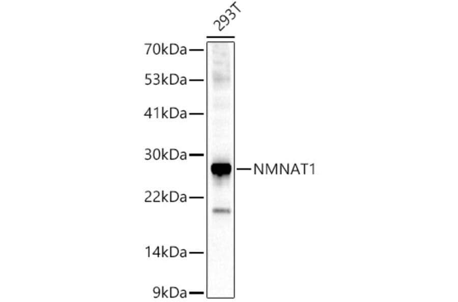 Western Blot - Anti-Nmnat1/NMNAT Antibody (A9602) - Antibodies.com