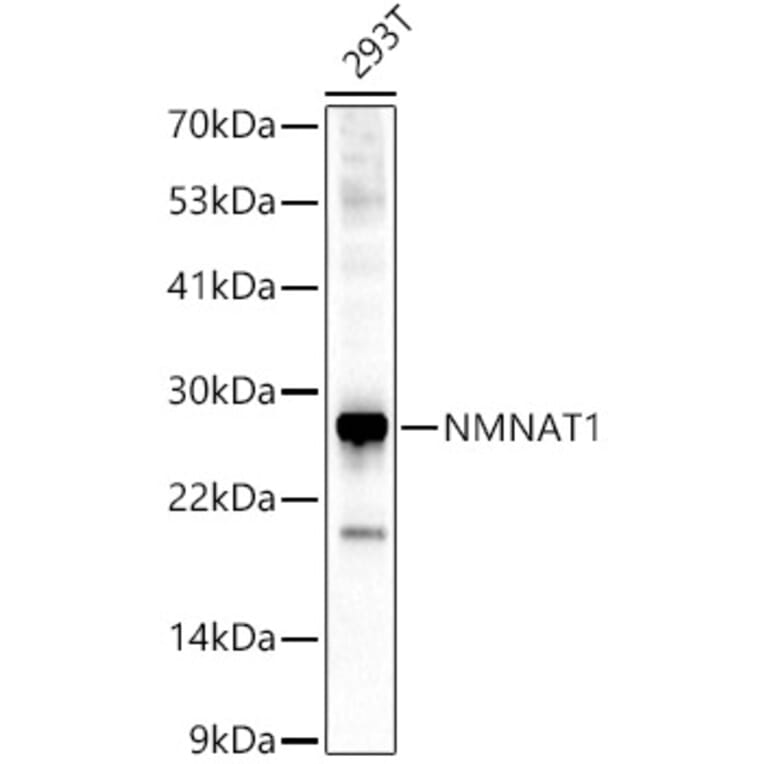 Western Blot - Anti-Nmnat1/NMNAT Antibody (A9602) - Antibodies.com