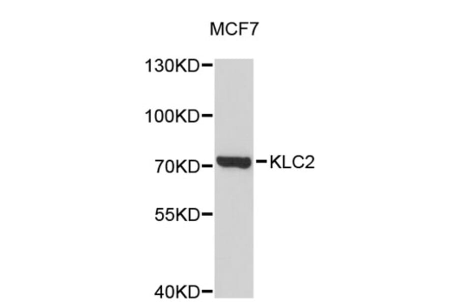 Western Blot - Anti-KLC2 Antibody (A4938) - Antibodies.com