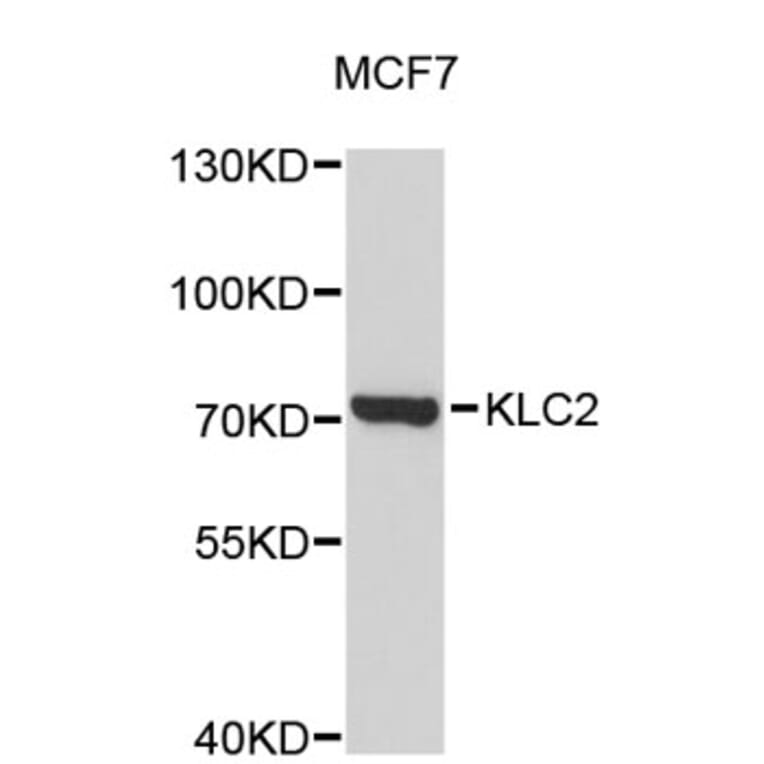Western Blot - Anti-KLC2 Antibody (A4938) - Antibodies.com