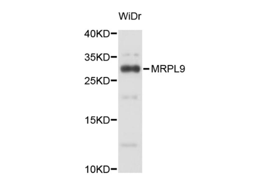 Western Blot - Anti-MRPL9 Antibody (A4946) - Antibodies.com