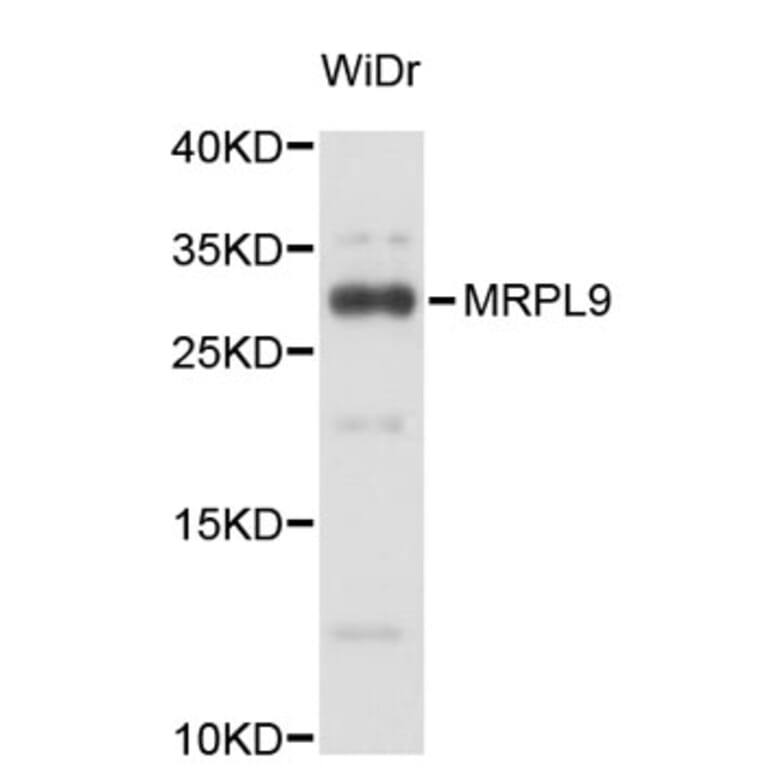 Western Blot - Anti-MRPL9 Antibody (A4946) - Antibodies.com