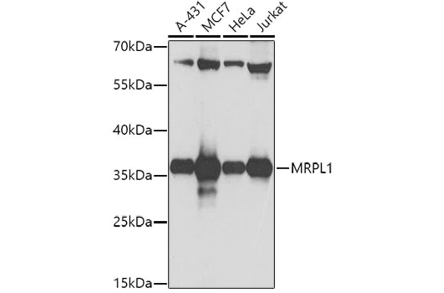 Western Blot - Anti-MRPL1 Antibody (A9606) - Antibodies.com