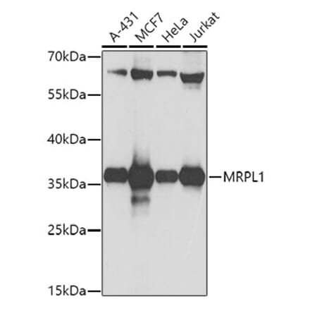 Western Blot - Anti-MRPL1 Antibody (A9606) - Antibodies.com