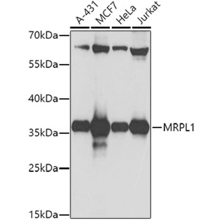 Western Blot - Anti-MRPL1 Antibody (A9606) - Antibodies.com