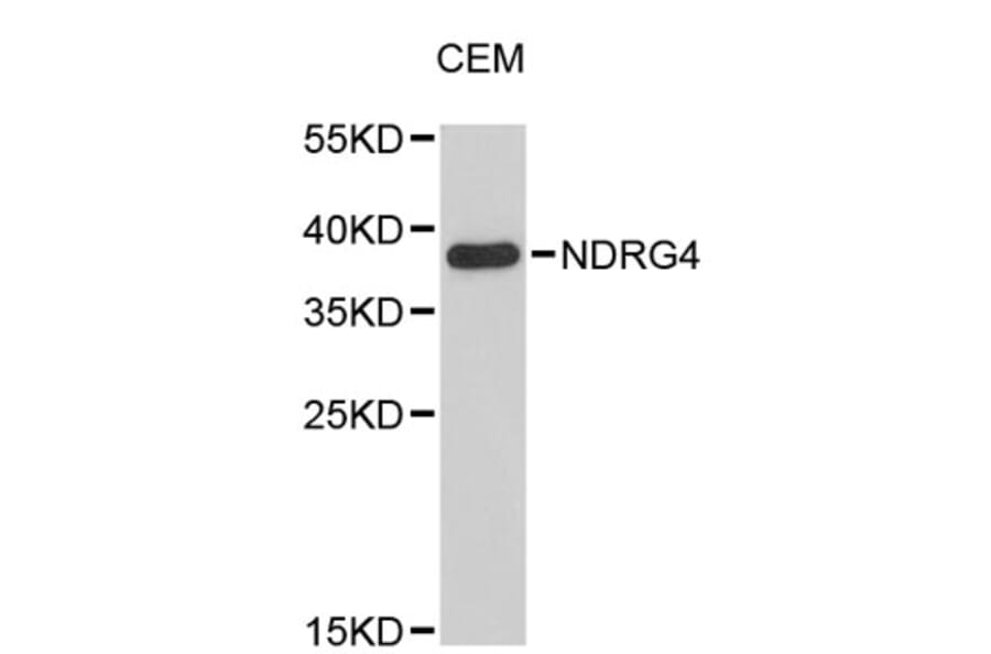 Western Blot - Anti-NDRG4 Antibody (A4948) - Antibodies.com