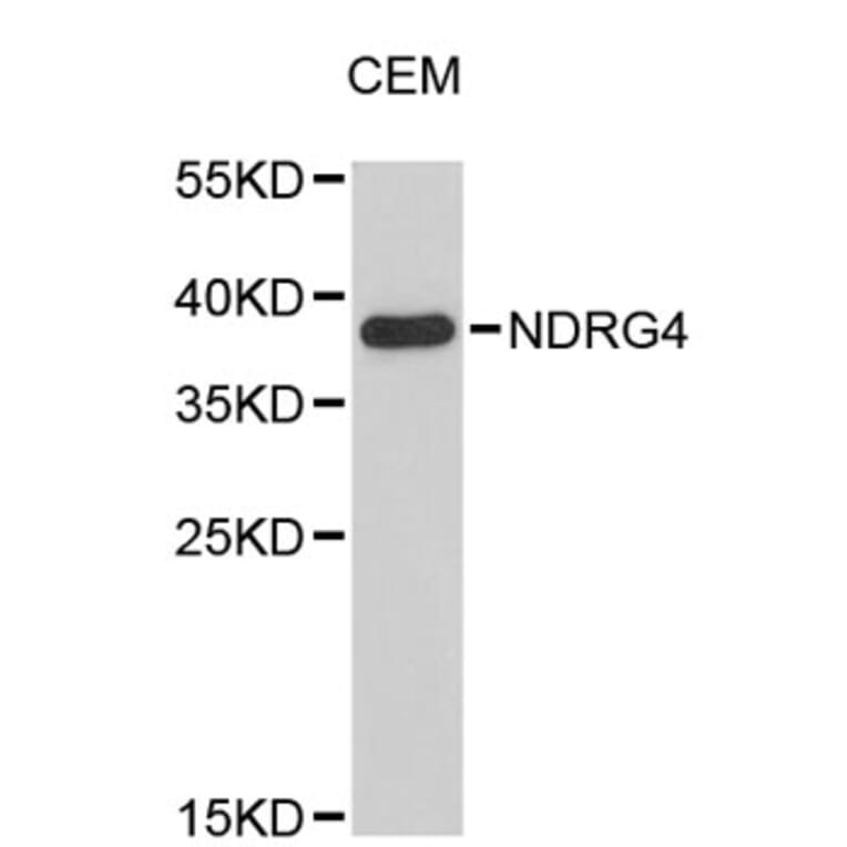 Western Blot - Anti-NDRG4 Antibody (A4948) - Antibodies.com