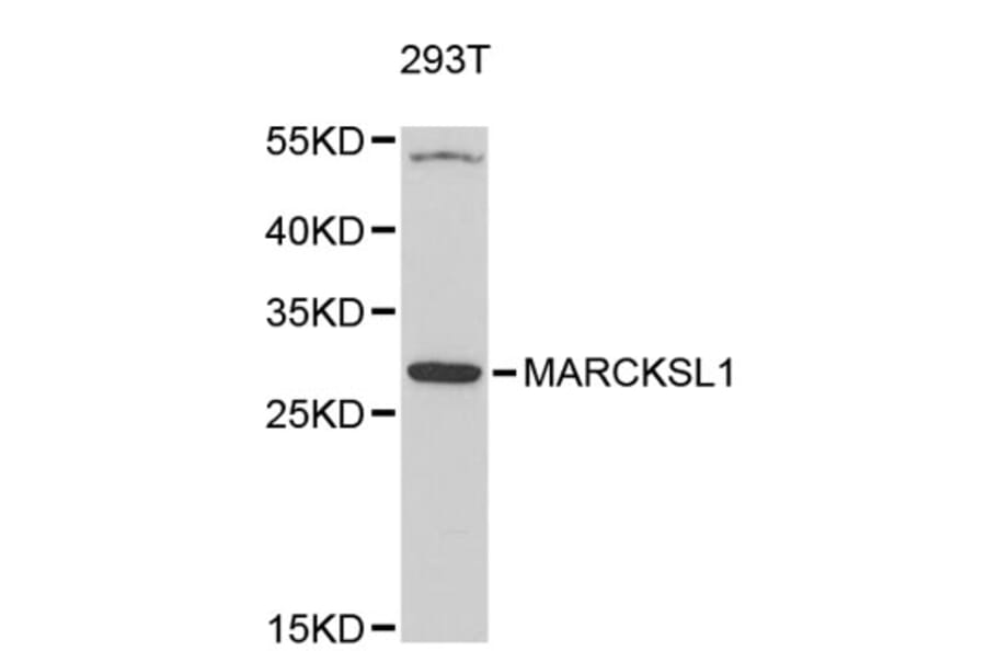 Western Blot - Anti-MARCKSL1 Antibody (A4950) - Antibodies.com