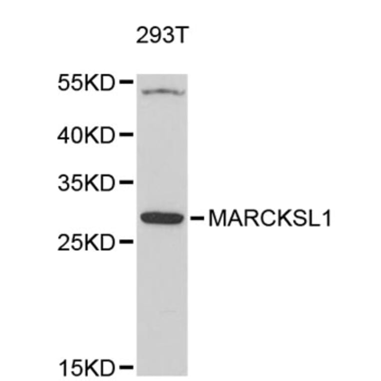 Western Blot - Anti-MARCKSL1 Antibody (A4950) - Antibodies.com