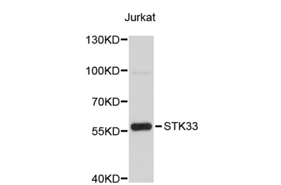 Western Blot - Anti-STK33 Antibody (A4952) - Antibodies.com