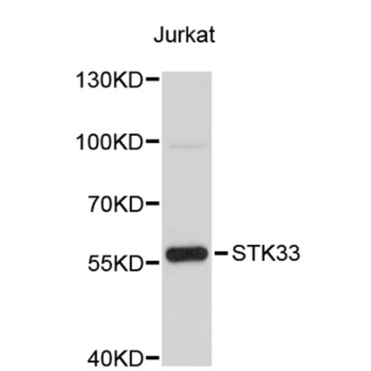Western Blot - Anti-STK33 Antibody (A4952) - Antibodies.com