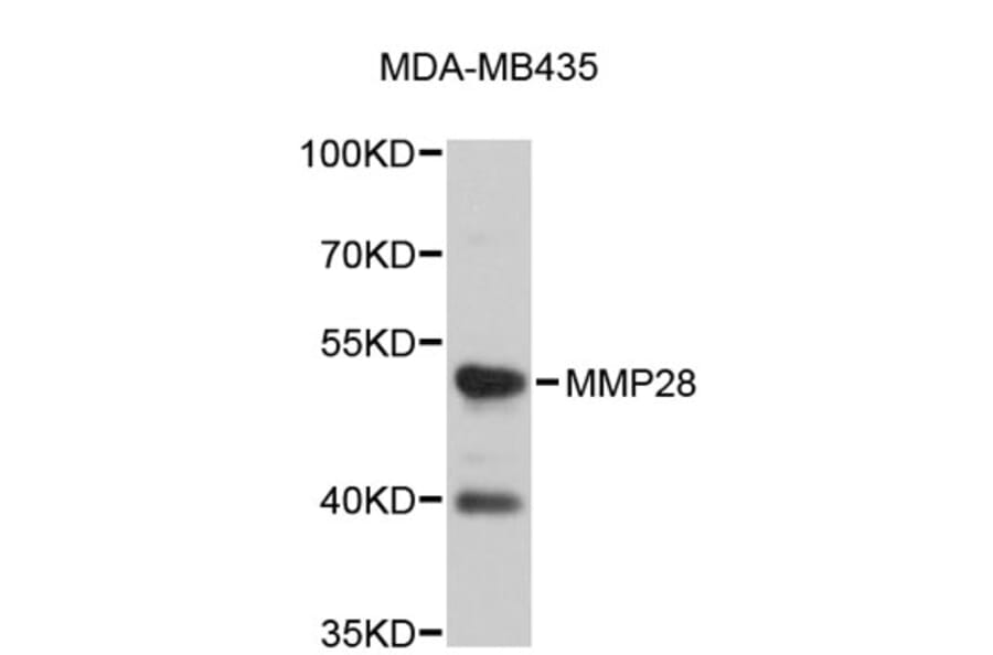 Western Blot - Anti-MMP28 Antibody (A4961) - Antibodies.com