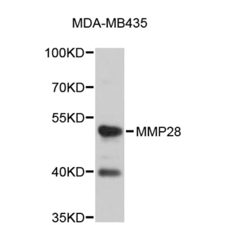 Western Blot - Anti-MMP28 Antibody (A4961) - Antibodies.com