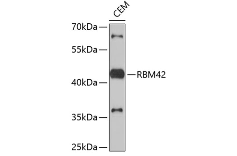 Western Blot - Anti-RBM42 Antibody (A4964) - Antibodies.com
