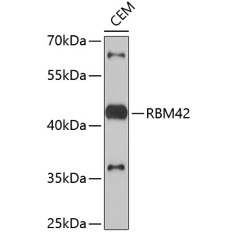 Western Blot - Anti-RBM42 Antibody (A4964) - Antibodies.com