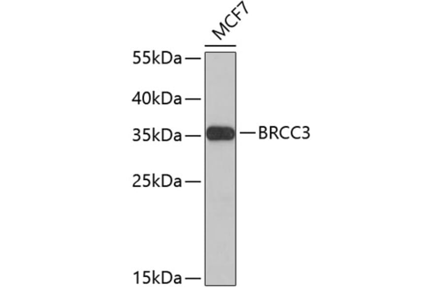 Western Blot - Anti-BRCC3 Antibody (A4965) - Antibodies.com