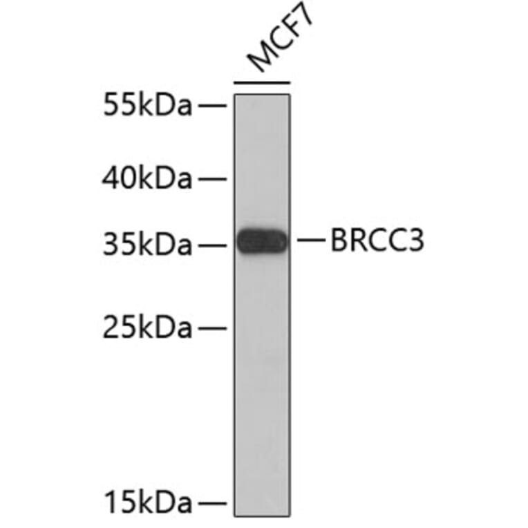 Western Blot - Anti-BRCC3 Antibody (A4965) - Antibodies.com