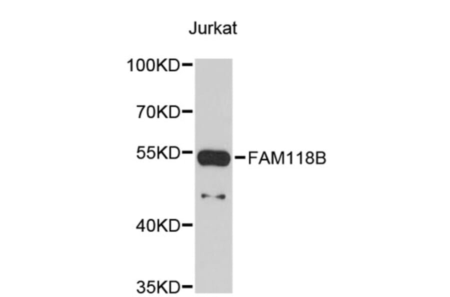 Western Blot - Anti-FAM118B Antibody (A4970) - Antibodies.com