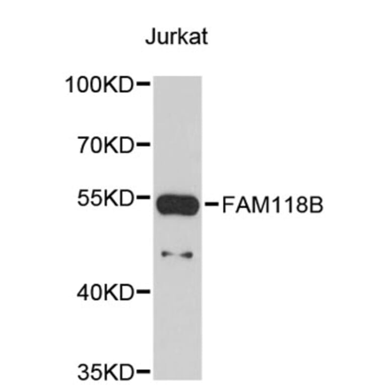 Western Blot - Anti-FAM118B Antibody (A4970) - Antibodies.com