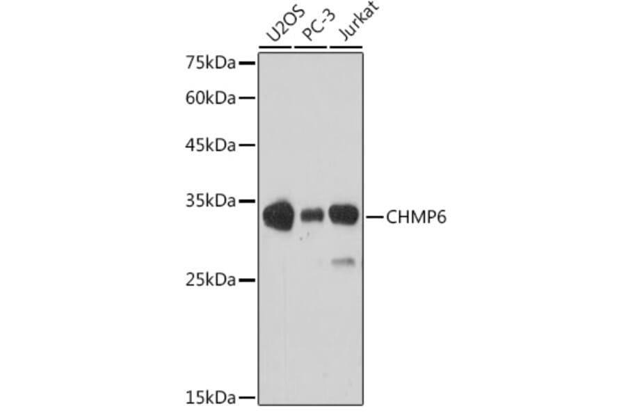 Western Blot - Anti-CHMP6/VPS20 Antibody (A9618) - Antibodies.com