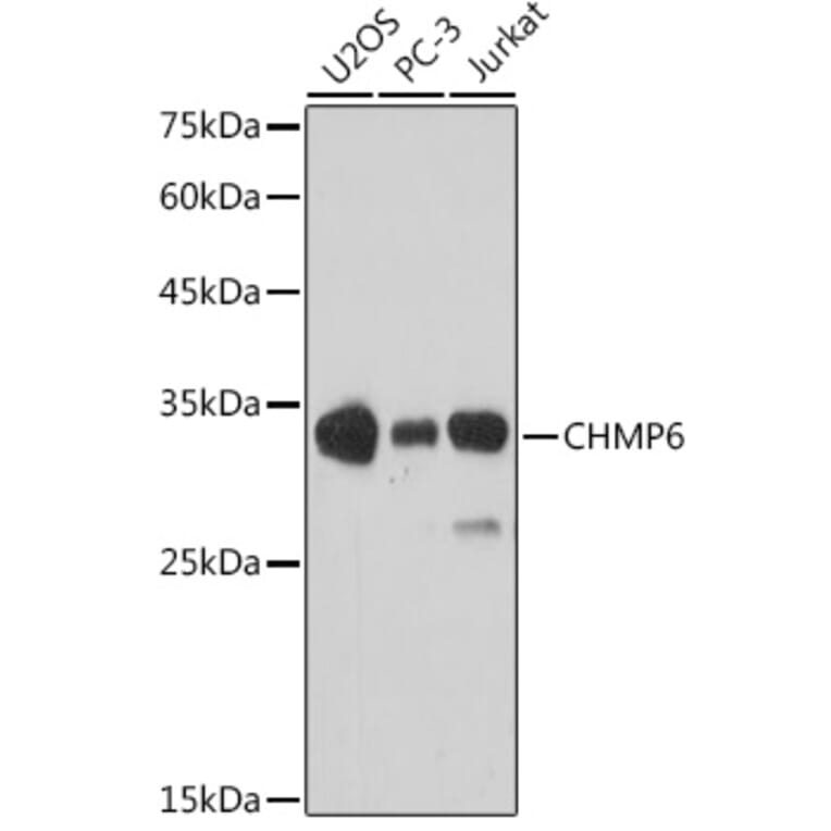 Western Blot - Anti-CHMP6/VPS20 Antibody (A9618) - Antibodies.com