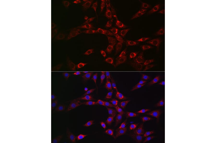 Immunofluorescence - Anti-CHMP6/VPS20 Antibody (A9618) - Antibodies.com