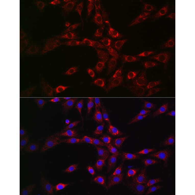Immunofluorescence - Anti-CHMP6/VPS20 Antibody (A9618) - Antibodies.com