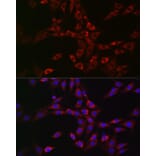 Immunofluorescence - Anti-CHMP6/VPS20 Antibody (A9618) - Antibodies.com