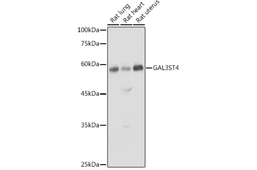 Western Blot - Anti-GAL3ST4 Antibody (A9619) - Antibodies.com
