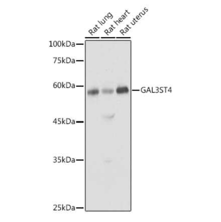 Western Blot - Anti-GAL3ST4 Antibody (A9619) - Antibodies.com