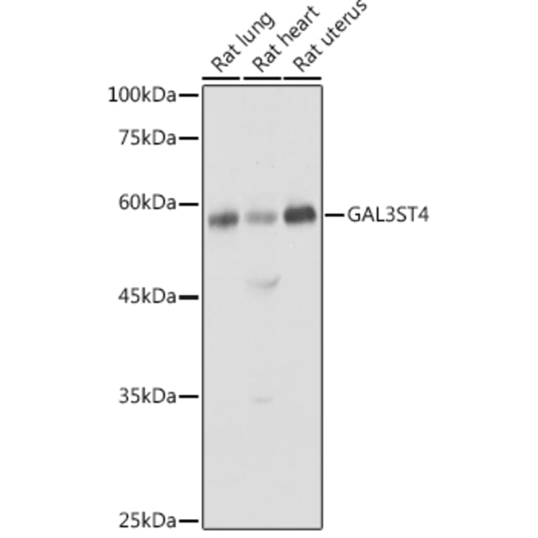Western Blot - Anti-GAL3ST4 Antibody (A9619) - Antibodies.com