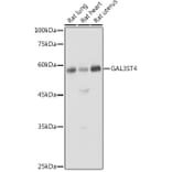 Western Blot - Anti-GAL3ST4 Antibody (A9619) - Antibodies.com
