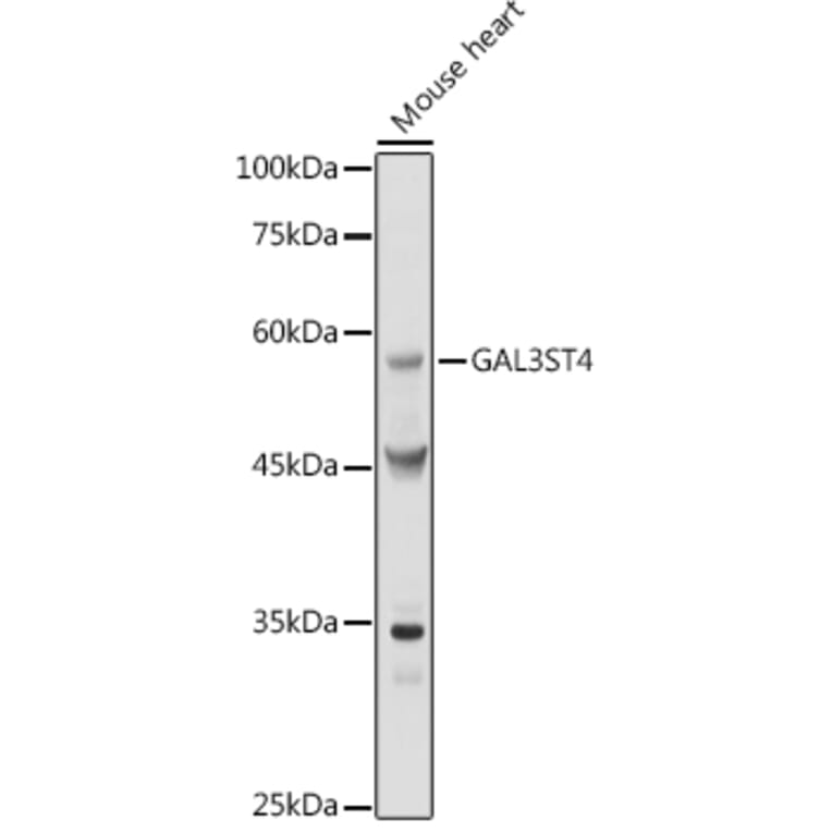 Western Blot - Anti-GAL3ST4 Antibody (A9619) - Antibodies.com