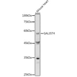 Western Blot - Anti-GAL3ST4 Antibody (A9619) - Antibodies.com