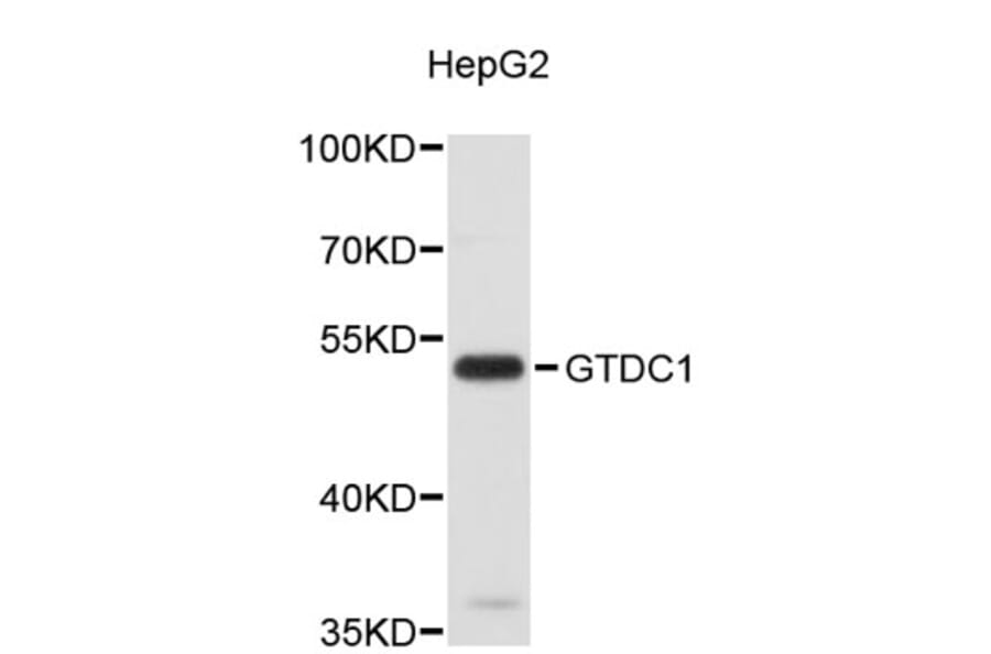 Western Blot - Anti-GTDC1 Antibody (A4980) - Antibodies.com