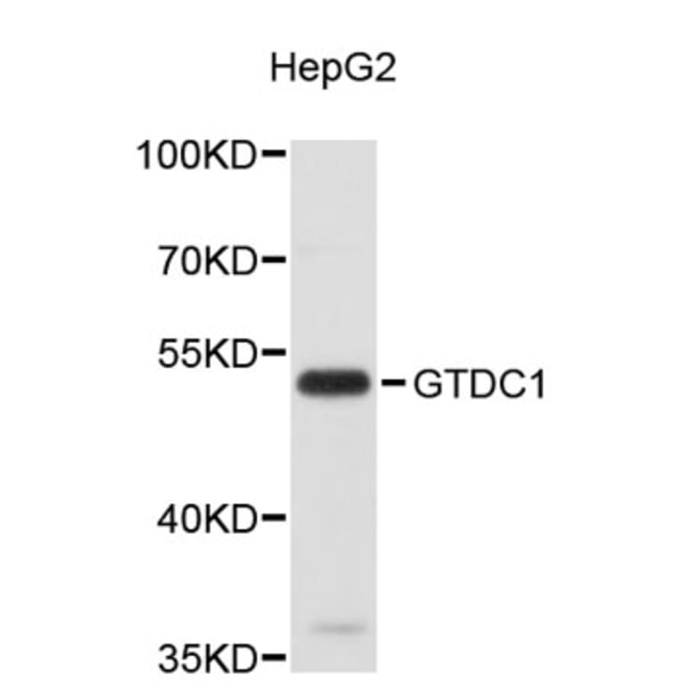 Western Blot - Anti-GTDC1 Antibody (A4980) - Antibodies.com