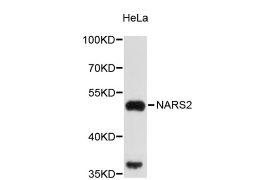Western Blot - Anti-NARS2 Antibody (A4982) - Antibodies.com