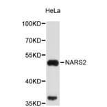 Western Blot - Anti-NARS2 Antibody (A4982) - Antibodies.com