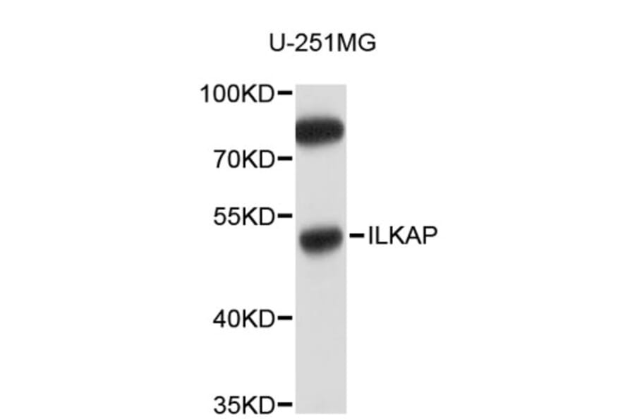 Western Blot - Anti-ILKAP Antibody (A5010) - Antibodies.com