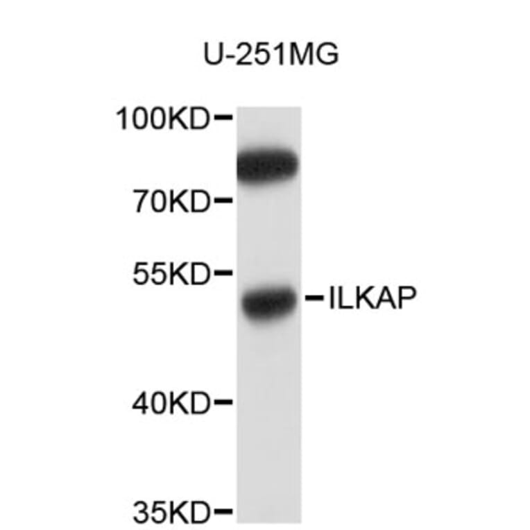 Western Blot - Anti-ILKAP Antibody (A5010) - Antibodies.com