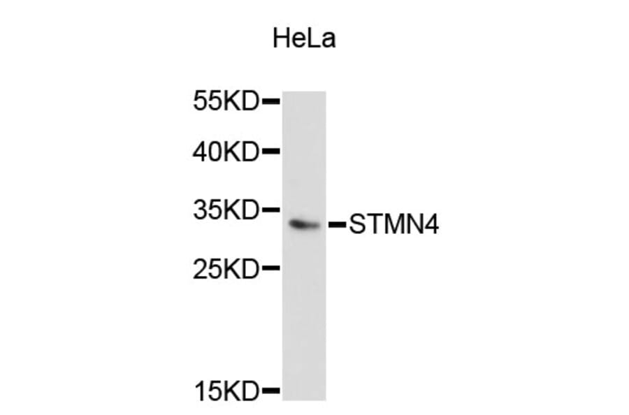 Western Blot - Anti-STMN4 Antibody (A5013) - Antibodies.com