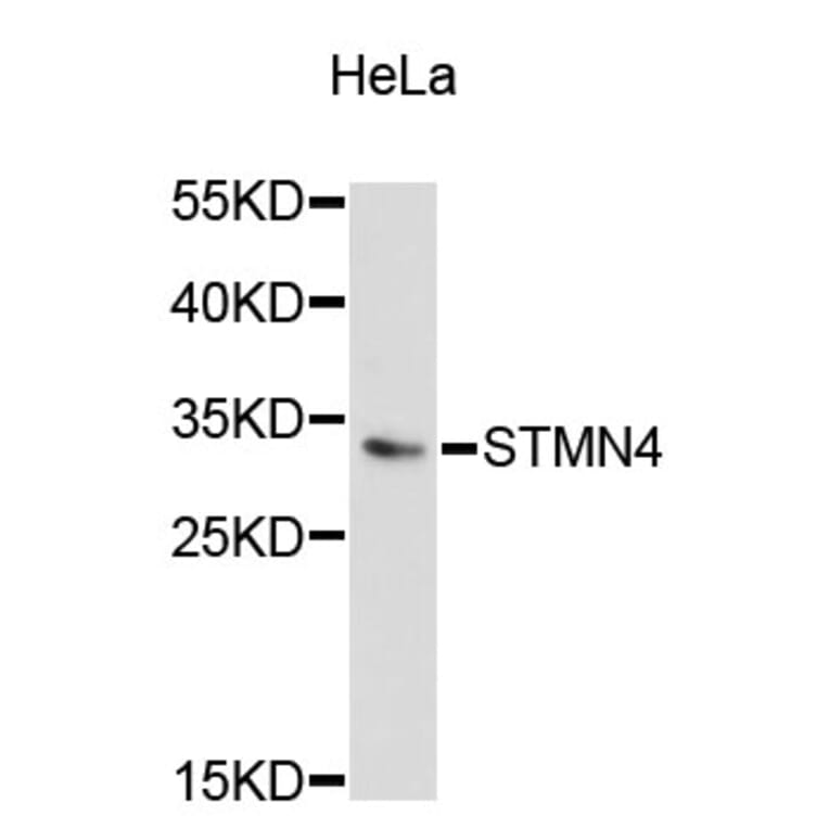 Western Blot - Anti-STMN4 Antibody (A5013) - Antibodies.com