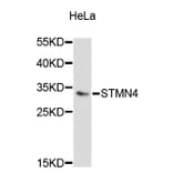 Western Blot - Anti-STMN4 Antibody (A5013) - Antibodies.com